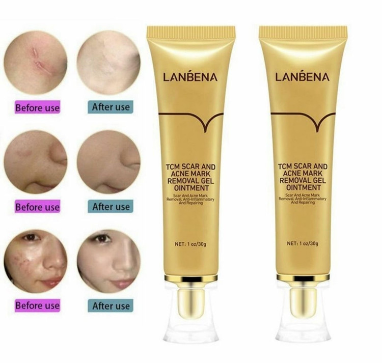 ژل ترمیم کننده قوی جای جوش و جای زخم اسکار لانبنا